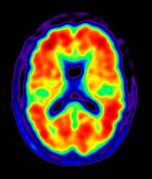 Brain - © General Index